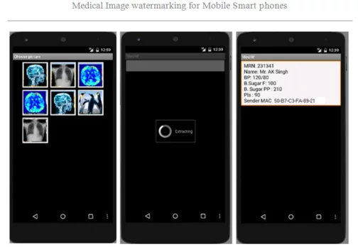 Medical Image Watermarking - Android Project